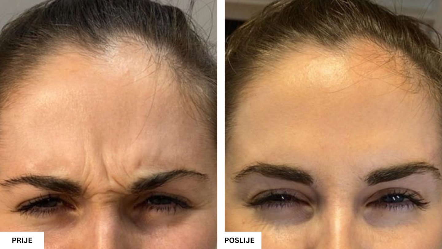 Beauty Aesthetic Centar Tuzla – Vrhunski estetski tretmani lica i tijela Beauty Aesthetic Centar Tuzla – Vrhunski estetski tretmani lica i tijela