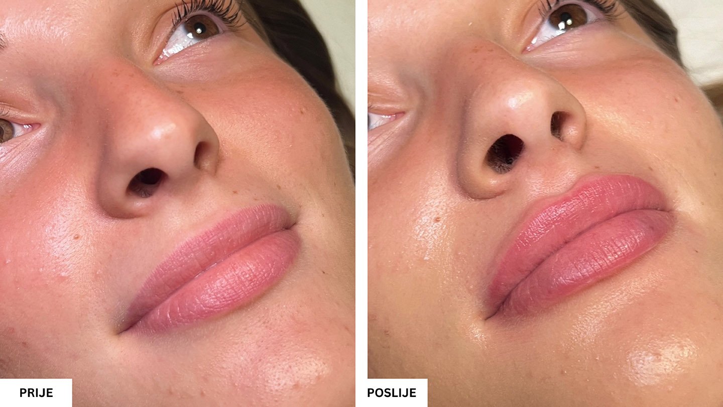 Beauty Aesthetic Centar Tuzla – Vrhunski estetski tretmani lica i tijela Beauty Aesthetic Centar Tuzla – Vrhunski estetski tretmani lica i tijela