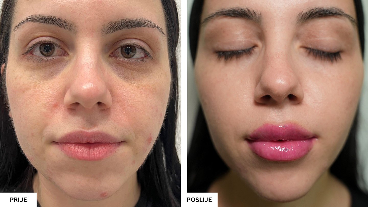 Beauty Aesthetic Centar Tuzla – Vrhunski estetski tretmani lica i tijela