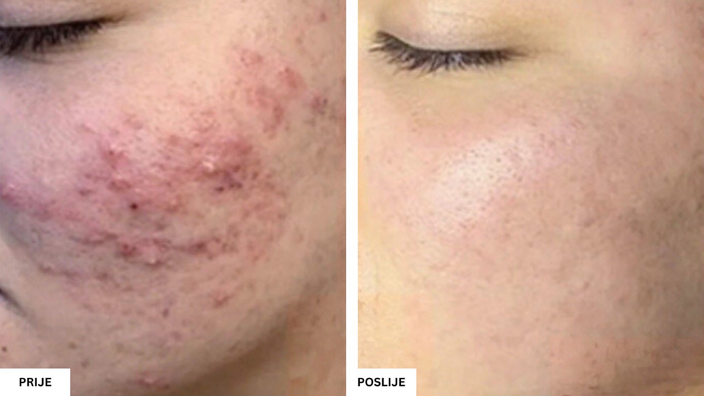 Beauty Aesthetic Centar Tuzla – Vrhunski estetski tretmani lica i tijela Beauty Aesthetic Centar Tuzla – Vrhunski estetski tretmani lica i tijela