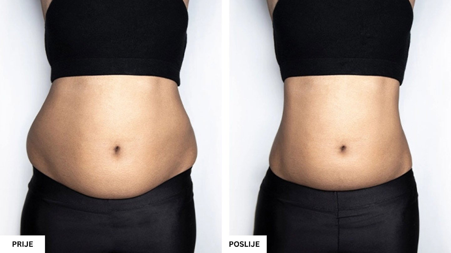 Beauty Aesthetic Centar Tuzla – Vrhunski estetski tretmani lica i tijela Beauty Aesthetic Centar Tuzla – Vrhunski estetski tretmani lica i tijela