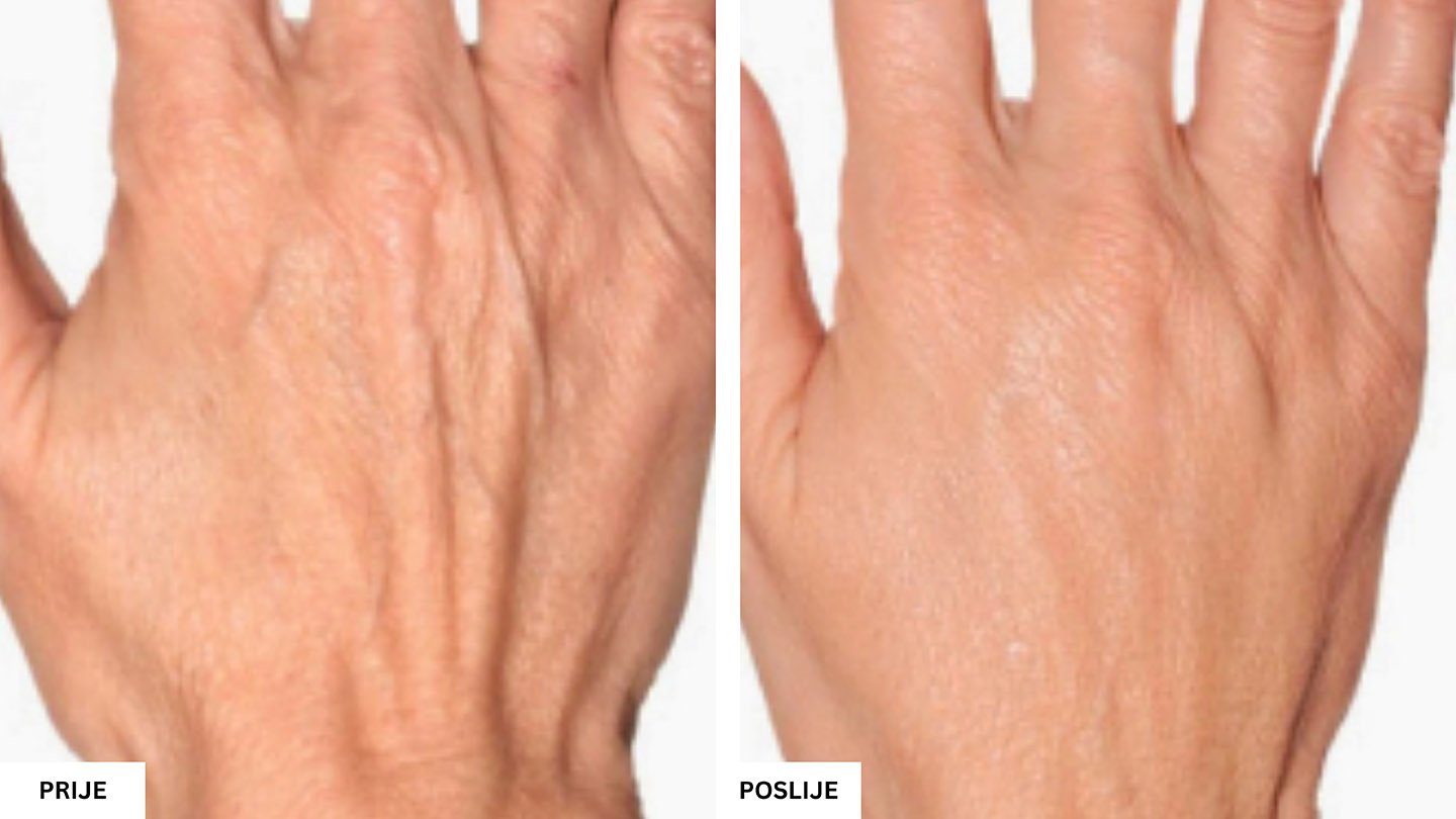 Beauty Aesthetic Centar Tuzla – Vrhunski estetski tretmani lica i tijela Beauty Aesthetic Centar Tuzla – Vrhunski estetski tretmani lica i tijela