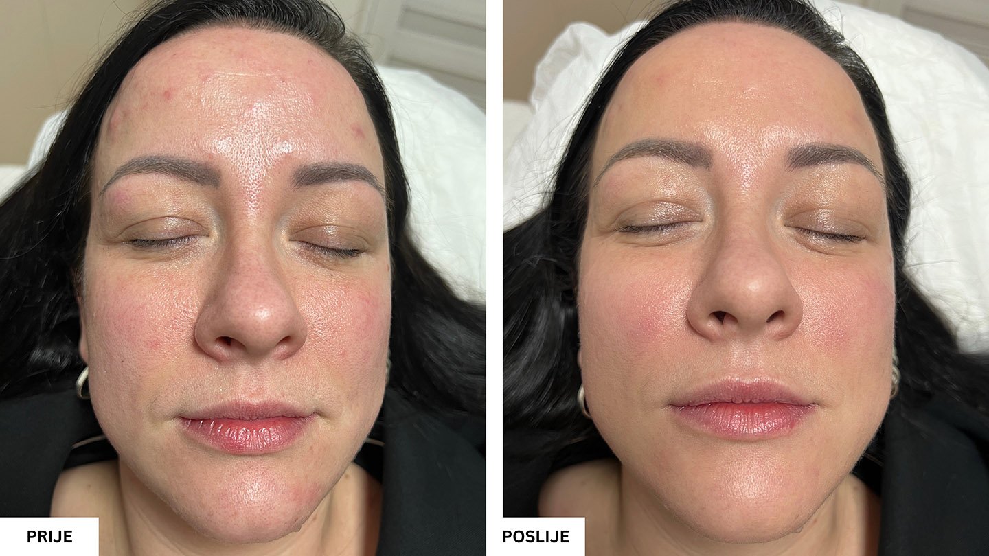 Beauty Aesthetic Centar Tuzla – Vrhunski estetski tretmani lica i tijela Beauty Aesthetic Centar Tuzla – Vrhunski estetski tretmani lica i tijela